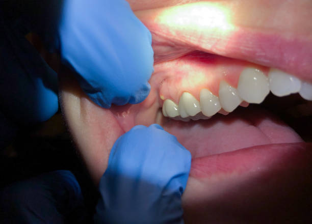 Best Emergency TMJ Treatment in Cresson, TX