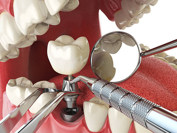 Best Cosmetic Emergency Dentistry in Cresson, TX